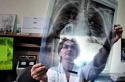 Mörkning i lungorna på fluorografi visar tuberkulos eller lunginflammation