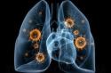 Kan fluorografi visa lunginflammation?